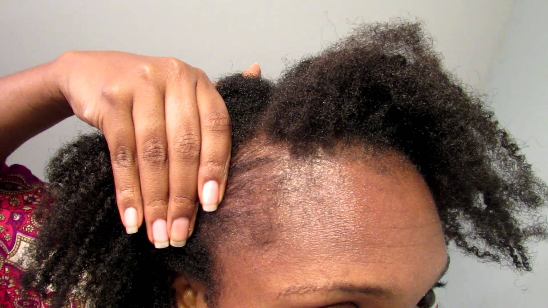 Re Growing The Edges Of Hair After Braiding Or Fixing Weaves Within Favorite Braided Hairstyles Cover Bald Edges (View 11 of 15)