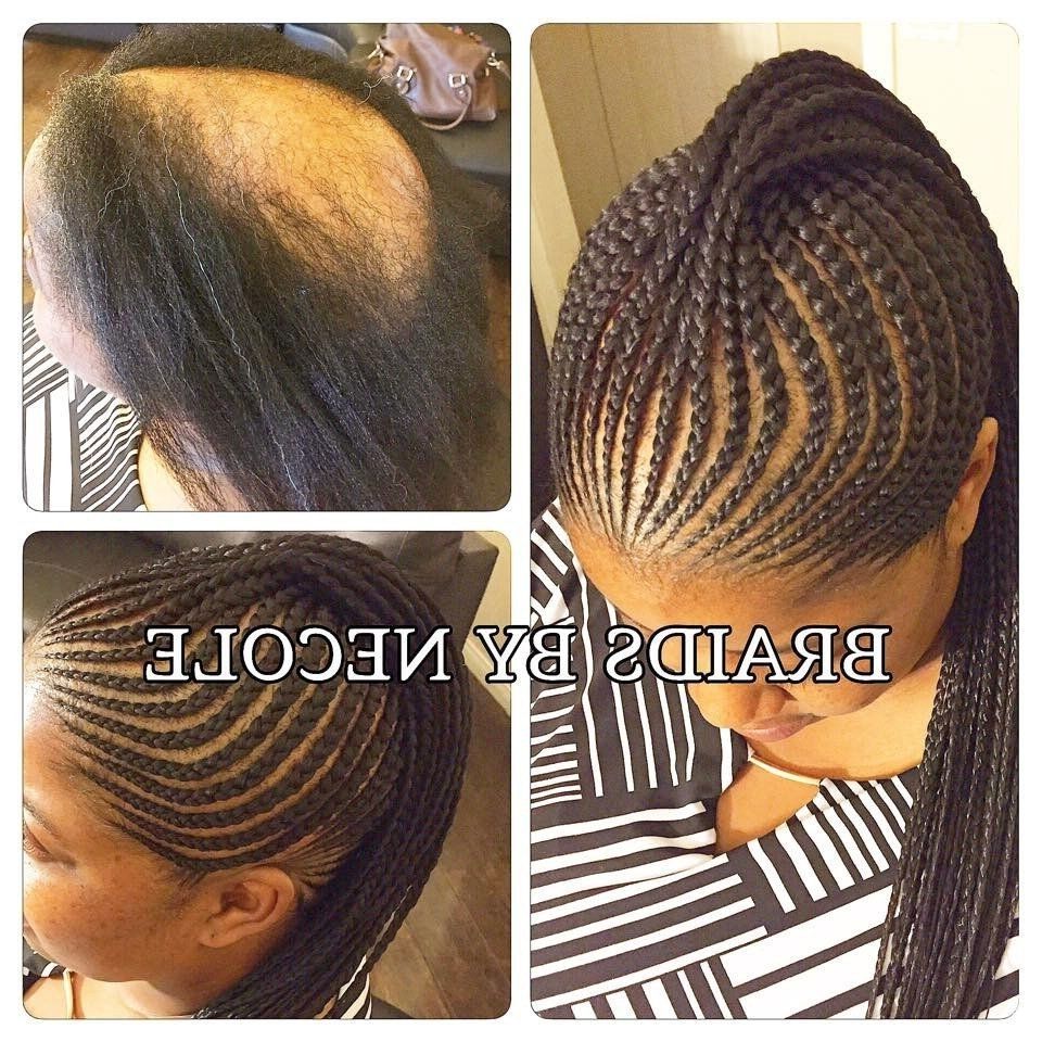14 Extraordinary Alopecia Camouflage Cornrowsbraidsnecole Throughout Popular Cornrows Hairstyles With No Edges (View 8 of 15)