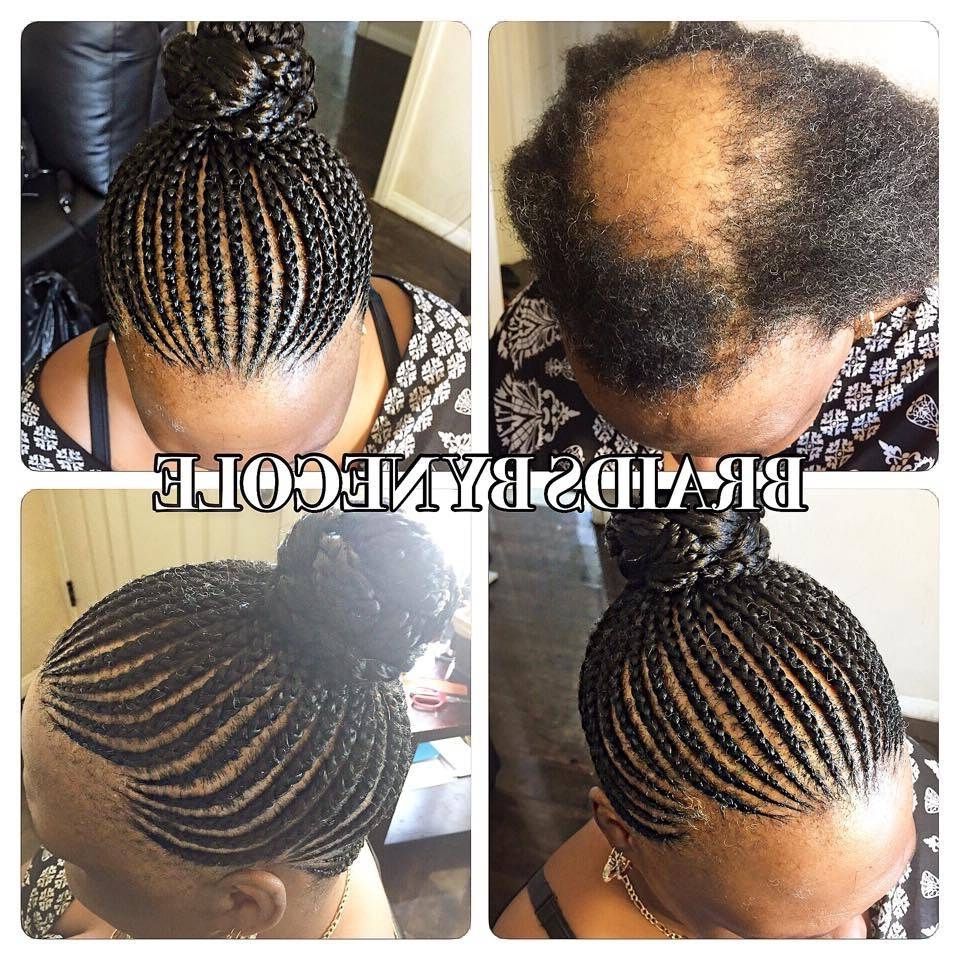 14 Extraordinary Alopecia Camouflage Cornrowsbraidsnecole Within 2018 Updo With Thin Wavy Feed Ins (View 14 of 15)