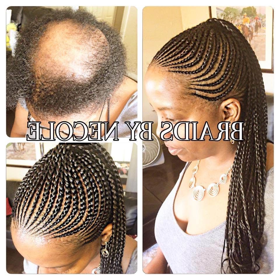 14 Extraordinary Alopecia Camouflage Cornrowsbraids Within Most Recent Cherry Lemonade Braided Hairstyles (View 14 of 20)