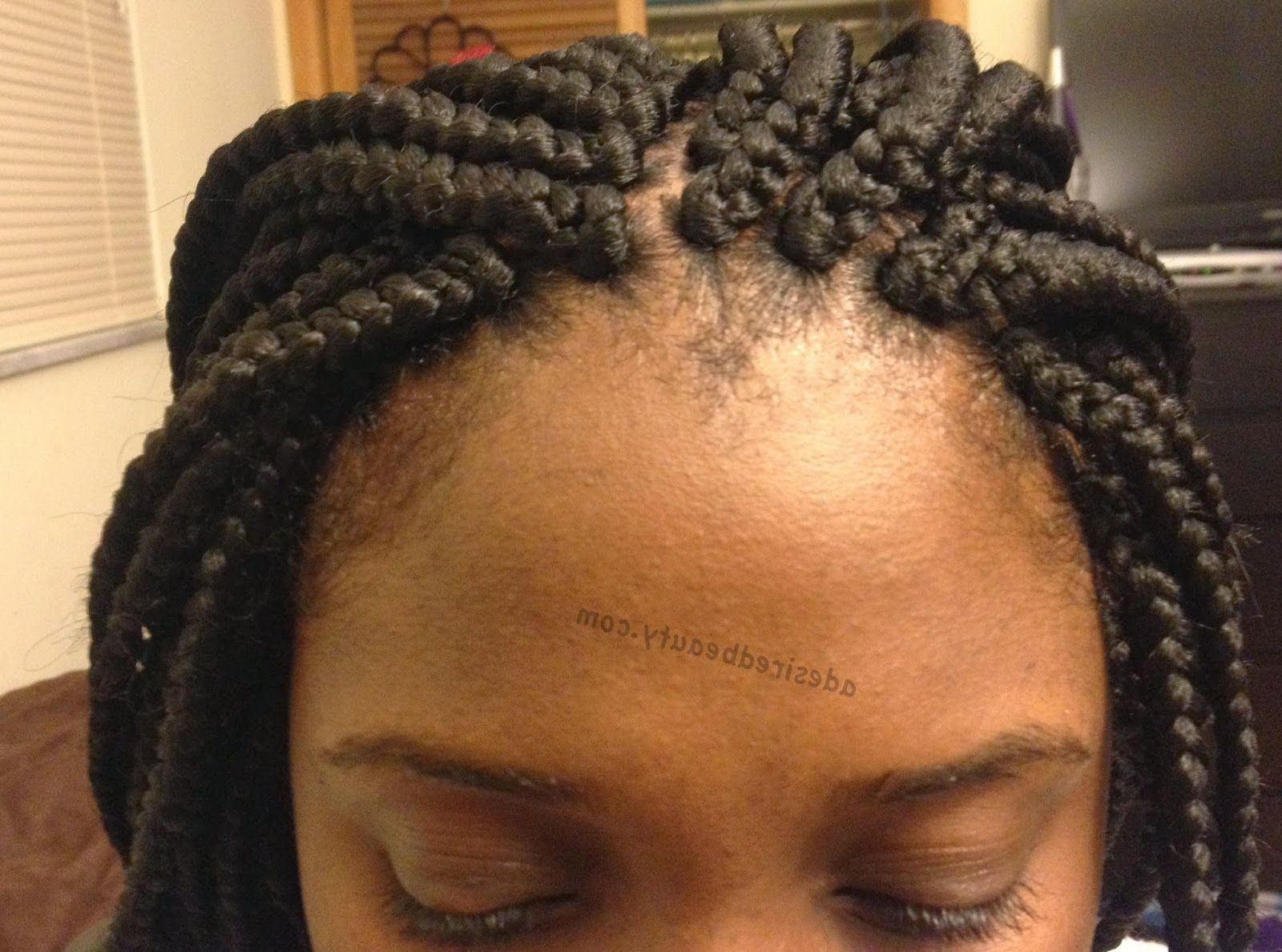 [%popular Dookie Braid Bump Hairstyles With My [traumatic] Box Braid Installation | A Desired Beauty|my [traumatic] Box Braid Installation | A Desired Beauty Within Most Up To Date Dookie Braid Bump Hairstyles%] (View 11 of 20)