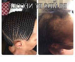 15 Best Collection of Braided Hairstyles Cover Bald Edges