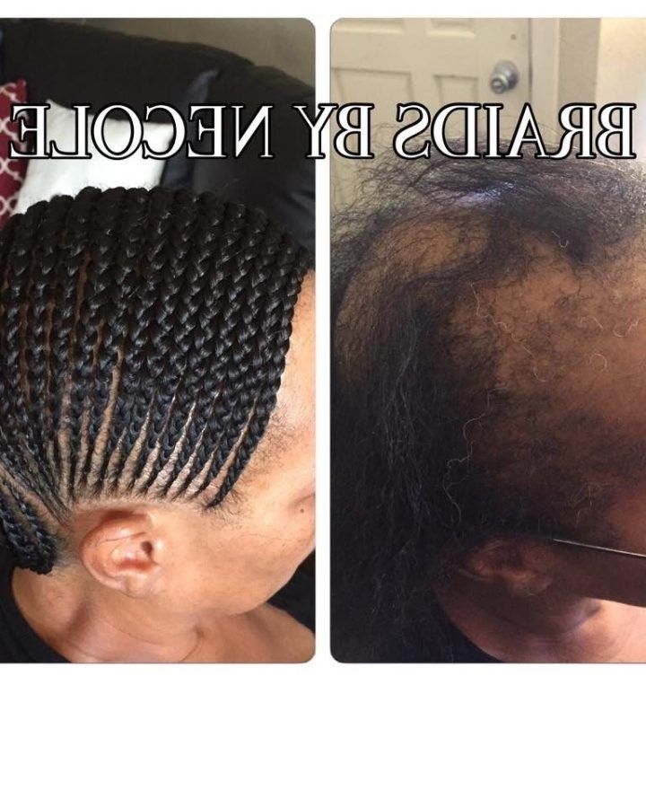 15 Best Collection of Braided Hairstyles Cover Bald Edges