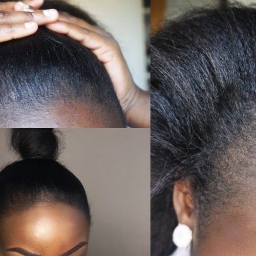 Braided Hairstyles Cover Bald Edges (Photo 3 of 15)